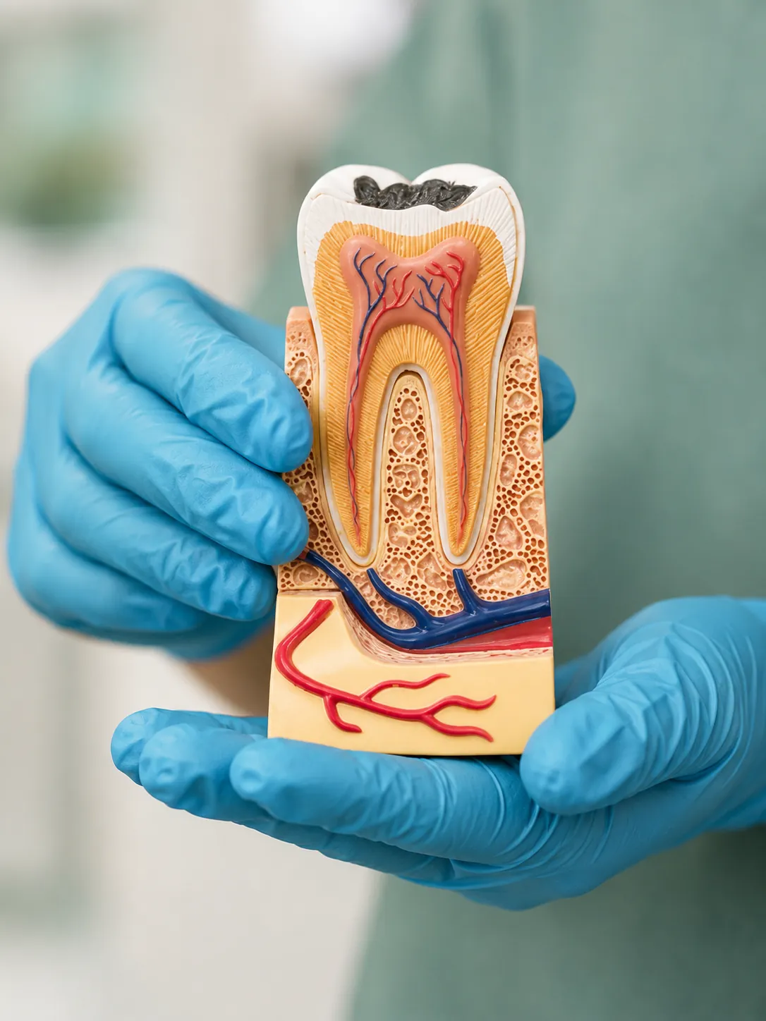 Atendimento de Endodontia na Implantar
